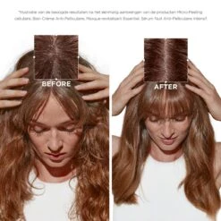 Kérastase Kerastase Symbiose Micro-Peeling Cellulaire 200ml -Winkel Voor Haarverzorgingsproducten 3474637135744 13