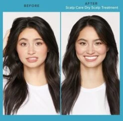 Living Proof Scalp Care Dry Scalp Treatment 100ml -Winkel Voor Haarverzorgingsproducten scalp care dry scalp sfeerfoto 2